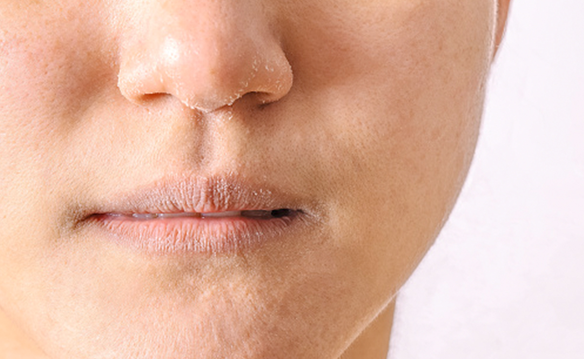 Dry skin  में लाना है नमी तो करें ये खास उपाय, नहीं पड़ेगी महंगी क्रीम की जरूरत