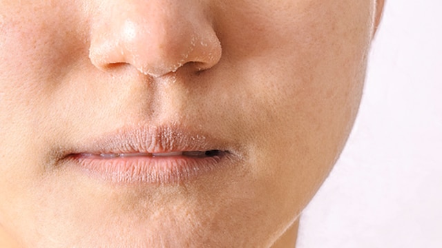 Staying hydrated from within is equally important for maintaining hydrated and moisturised skin