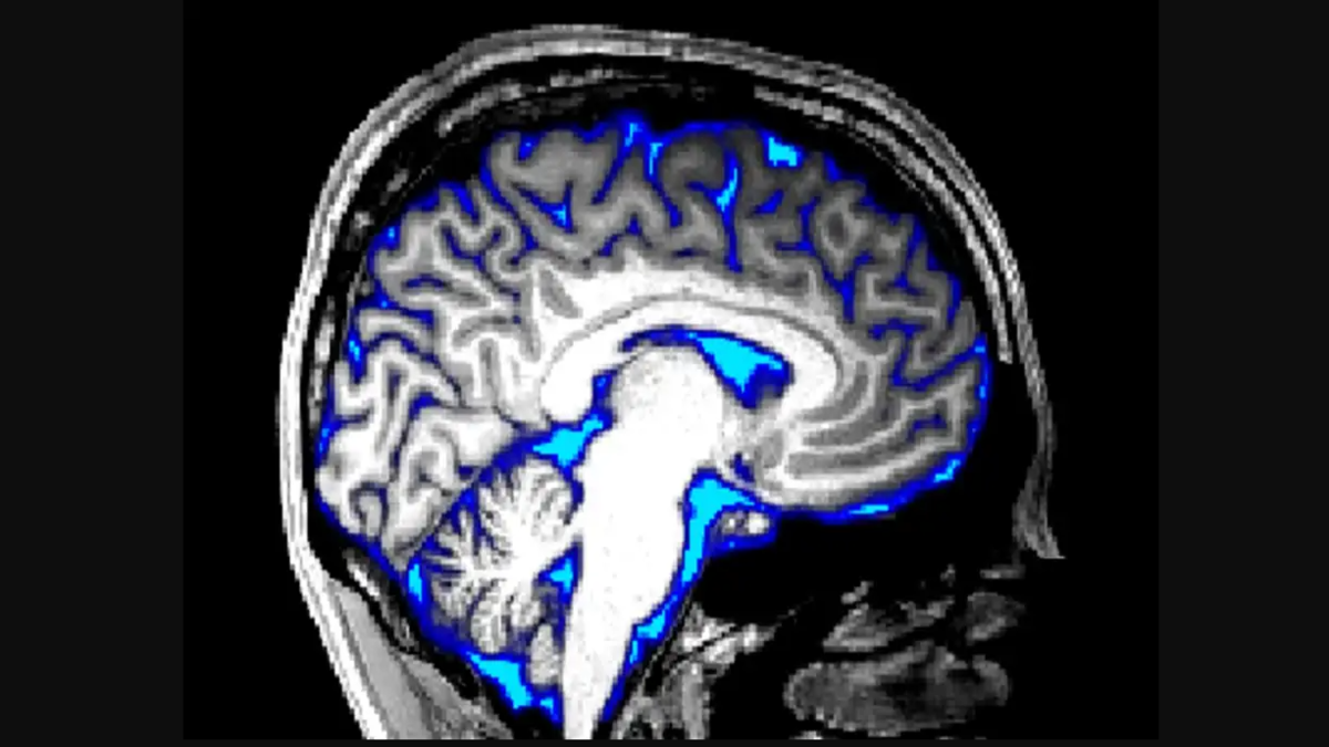 Harvard-Backed AI Tool Cracks Cancer's Genome During Surgery