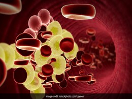 High Cholesterol: गंदे कॉलेस्ट्रोल को कम कर सकते हैं ये काले-सफेद बीज, वजन भी घटता है  High Cholesterol: गंदे कॉलेस्ट्रोल को कम कर सकते हैं ये काले-सफेद बीज, वजन भी घटता है