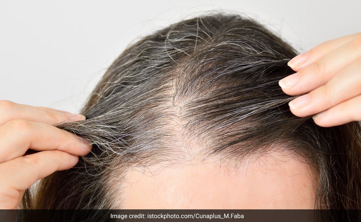 बालों को प्राकृतिक रूप से काला करते हैं कुछ तेल, सफेद बालों की दिक्कत हो जाती है दूर 