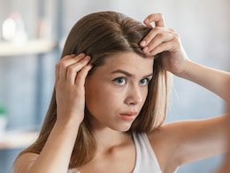 Scalp Pimples Can Impact Your Hair Growth: Here's What To Do About Them