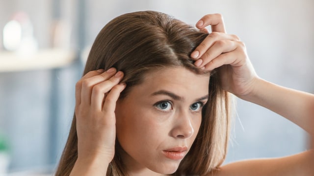 Acute folliculitis typically causes transient hair shedding