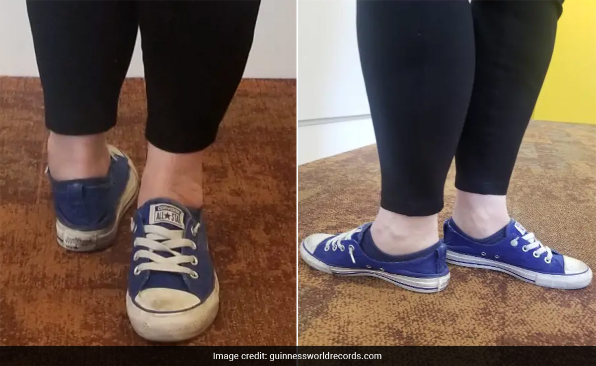 Woman Breaks Guinness World Records By Rotating Her Feet Back-To-Front