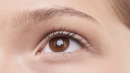 What Is Eyelash Dandruff? Have You Heard About This?
