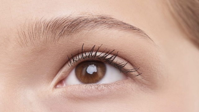 What Is Eyelash Dandruff? Have You Heard About This?
