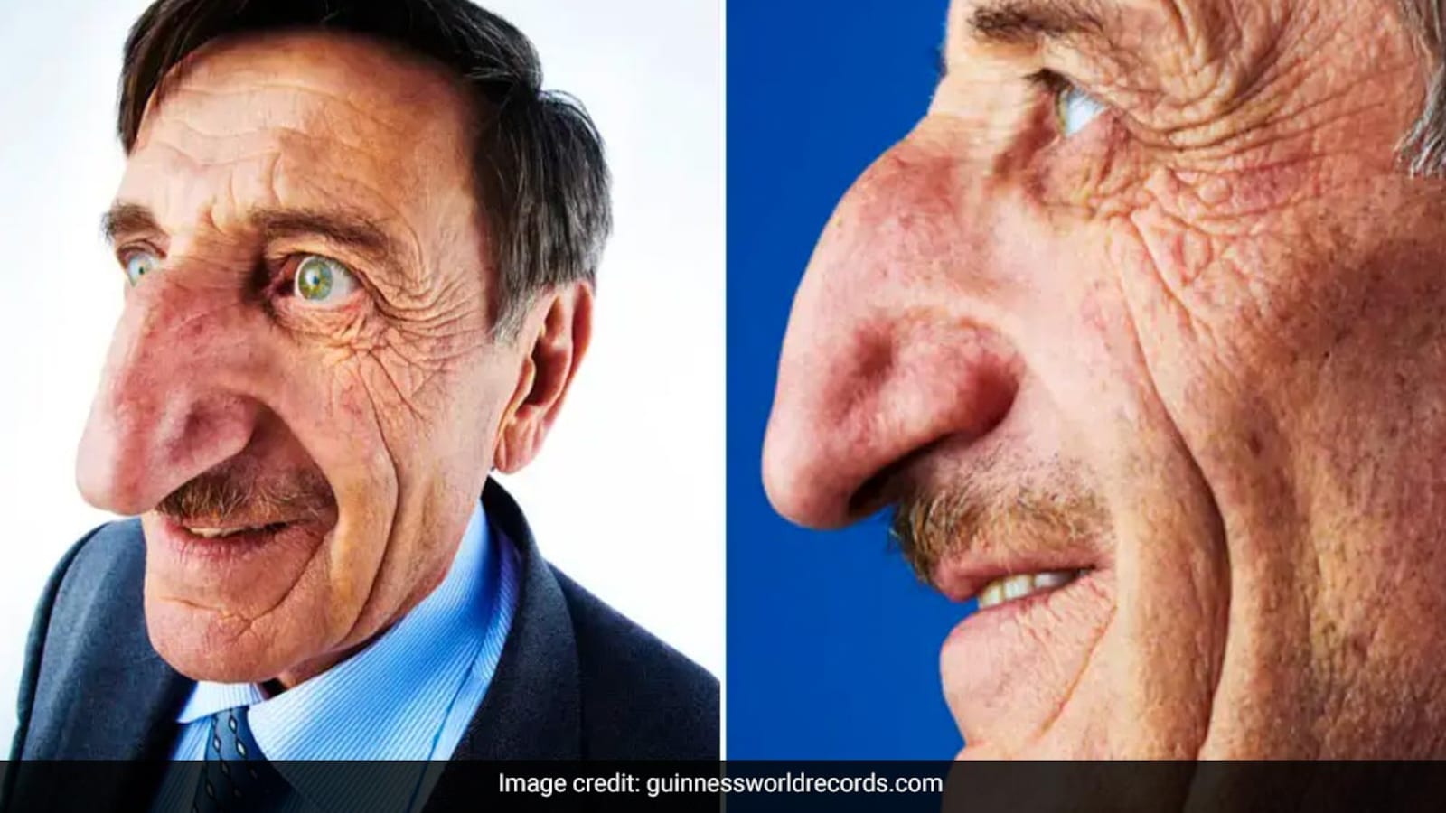 Mehmet Ozyurek, Man With World's Longest Nose, Dies At 75