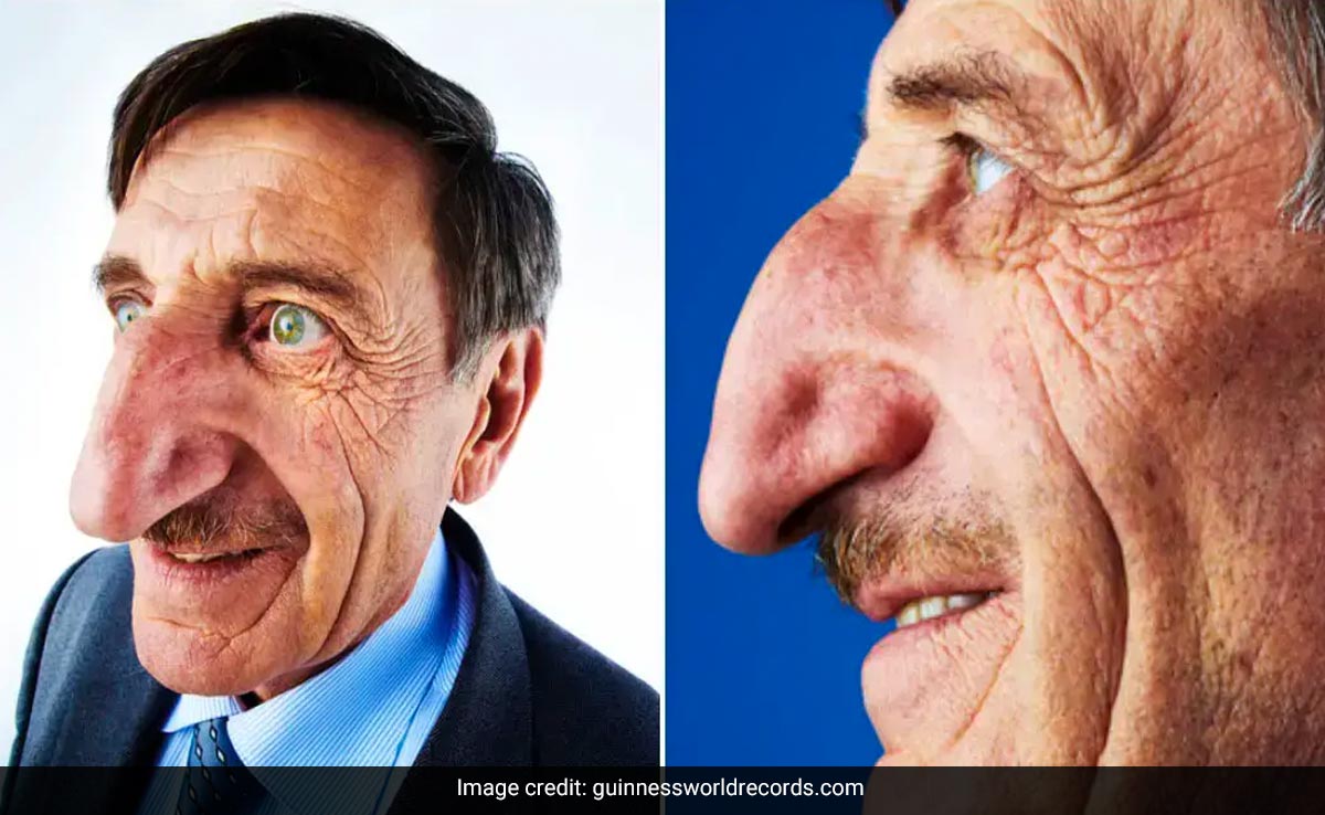 Man with the world's longest nose, Mehmet Ozyurek, dies at 75