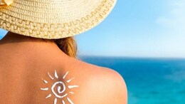 धूप से हो रहा है Sunburn, झुलसी स्किन को निखार देंगीं ये Home Remedies&nbsp;