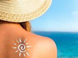धूप से हो रहा है Sunburn, झुलसी स्किन को निखार देंगीं ये Home Remedies  धूप से हो रहा है Sunburn, झुलसी स्किन को निखार देंगीं ये Home Remedies