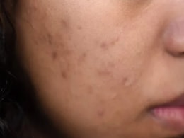 एक्सपर्ट ने बताया घर पर तैयार इस नेचुरल टोनर से एक्ने, open pores और Pigmentation से राहत पाने का आसान तरीका एक्सपर्ट ने बताया घर पर तैयार इस नेचुरल टोनर से एक्ने, open pores और Pigmentation से राहत पाने का आसान तरीका