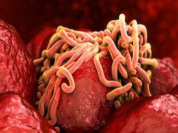 Pinworms infection: इन छोटे-छोटे कीड़ों की वजह से हो सकती है Anus में खुजली, भूख और नींद में कमी, जानें लक्षण, कारण और बचाव के उपाय... Pinworms infection: इन छोटे-छोटे कीड़ों की वजह से हो सकती है Anus में खुजली, भूख और नींद में कमी, जानें लक्षण, कारण और बचाव के उपाय...