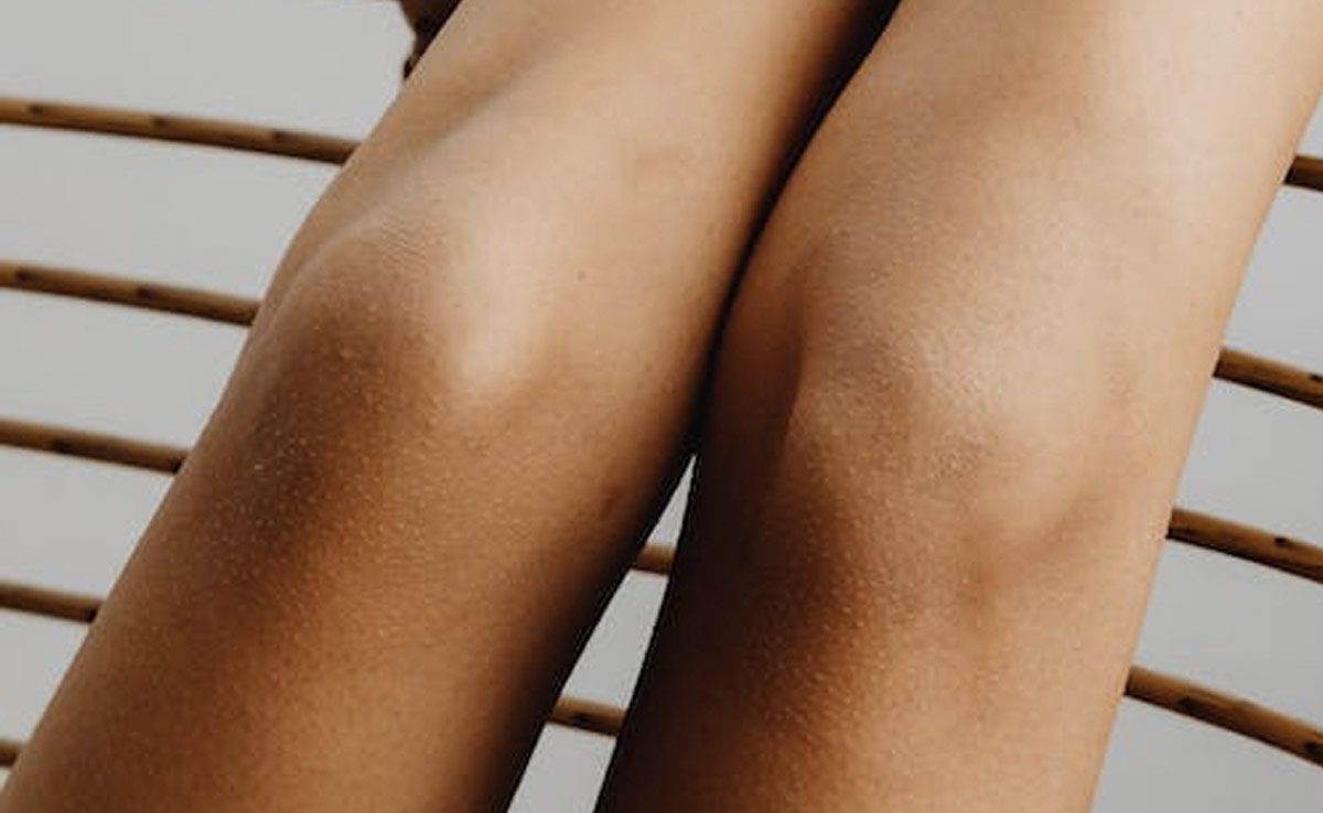 In The Season Of Mini Dresses And Short Skirts, Pick These 5 Home Remedies To Get Rid Of Dark Elbows And Knees