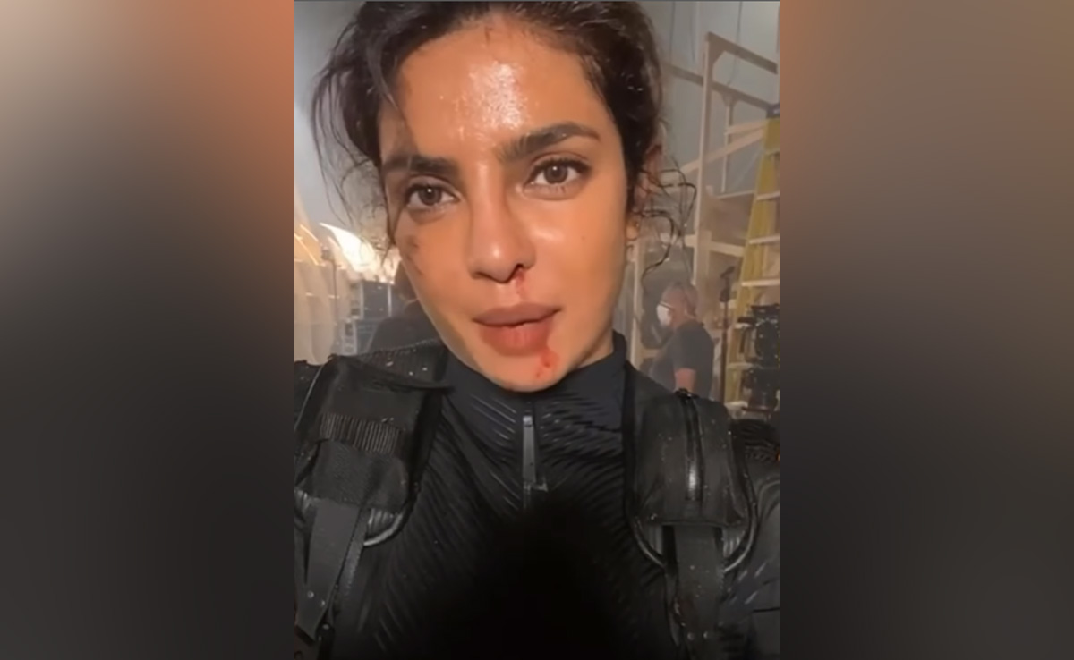 Priyanka Chopra Shares Evidence Of The "Blood, Sweat And Tears" That Went Into Her <i>Citadel</i> Role