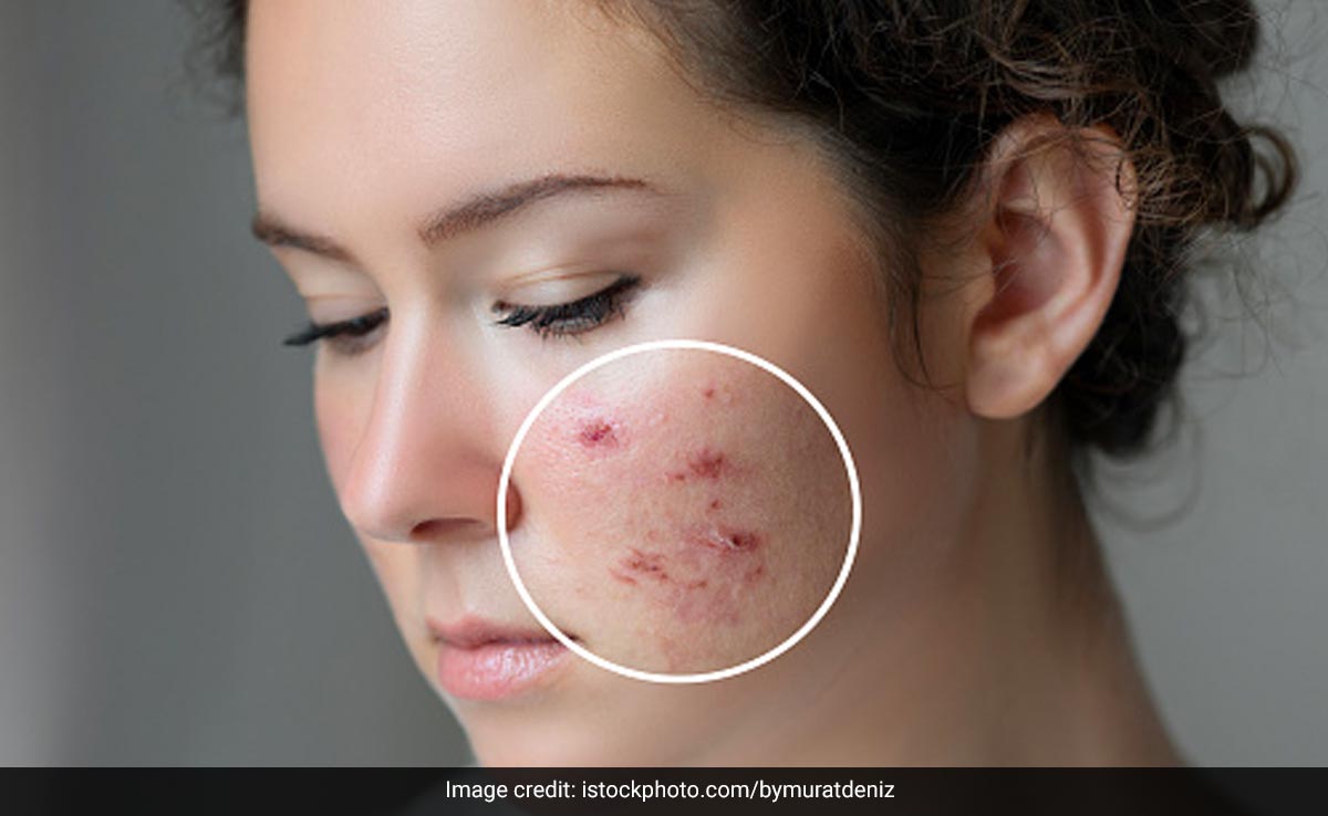 डर्माटोलॉजिस्ट से जानिए स्किन केयर में कौन सी 3 गलतियां कभी नहीं करनी चाहिए, त्वचा हो सकती है खराब