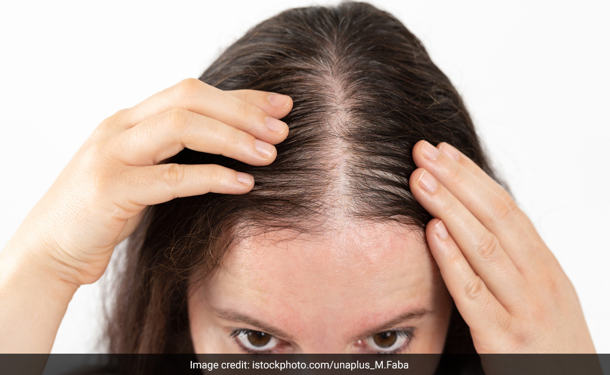 बालों के झड़ने से हैं परेशान तो हर रोज सुबह उठते ही करें इस चीज का सेवन, जल्द कंट्रोल हो सकता है हेयर फॉल