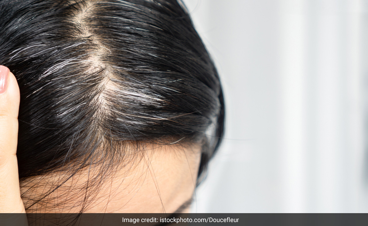 बालों को सफेद बना देती हैं ये 4 गलतियां, कहीं आप भी तो नहीं अपनाते White Hair बढ़ाने वाली आदतें 