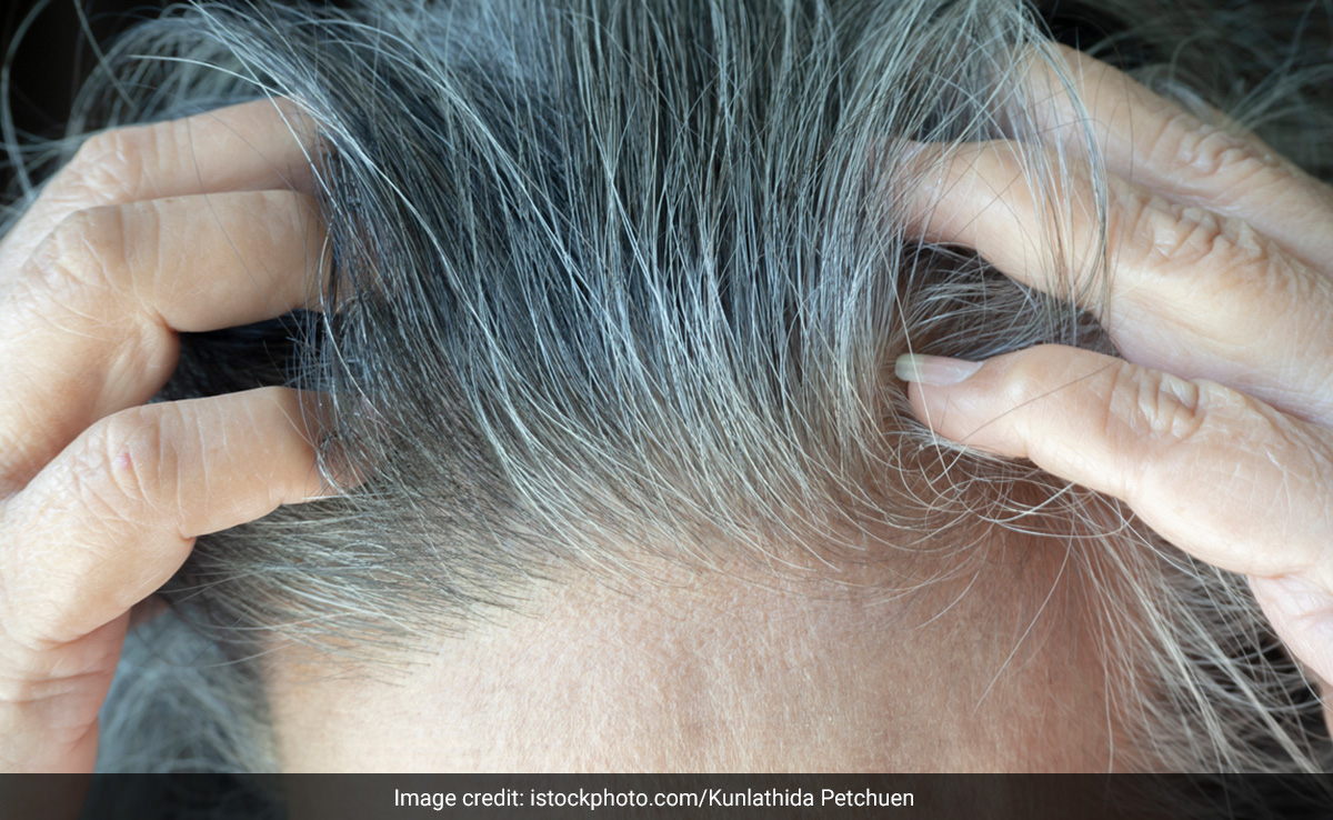 इस एक काले मसाले से सफेद बाल भी हो जाते हैं ब्लैक, White Hair के लिए नहीं लगानी पड़ेगी केमिकल वाली डाई 