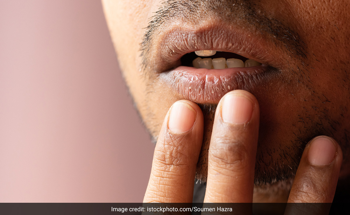 होठों के कालेपन से हैं परेशान तो कॉफी में यह एक चीज मिलाकर लगाना कर दीजिए शुरू, Pink Lips पा लेंगे आप