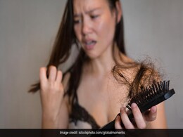 केमिकल प्रोडक्ट से नहीं बल्कि इन 4 जबरदस्त असरदार नेचुरली होम रेमेडी से रोकें बालों का झड़ना केमिकल प्रोडक्ट से नहीं बल्कि इन 4 जबरदस्त असरदार नेचुरली होम रेमेडी से रोकें बालों का झड़ना