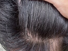 कम उम्र में सफेद हो गए हैं बाल, तो यहां जानिए किस चीज को लगाकर दूर होगी White Hair की दिक्कत  कम उम्र में सफेद हो गए हैं बाल, तो यहां जानिए किस चीज को लगाकर दूर होगी White Hair की दिक्कत