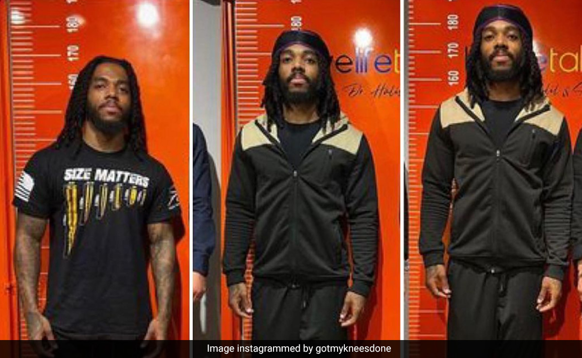 Man Tired Of Rejection By Women Spends Rs 66 Lakh On Leg Lengthening Surgery