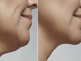 ये योगासन आपके चेहरे को करेंगे टाइट, ब्लड सर्कुलेशन होगा तेज