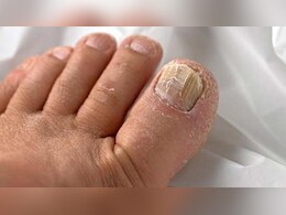 प्रोटीन की कमी पर शरीर में नजर आते हैं ये 5 लक्षण, डॉक्टर ने बताया घर में मौजूद ये चीजें खाना कर दें शुरू प्रोटीन की कमी पर शरीर में नजर आते हैं ये 5 लक्षण, डॉक्टर ने बताया घर में मौजूद ये चीजें खाना कर दें शुरू