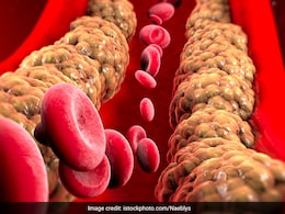 नसों में जमी कोलेस्ट्रॉल की मोटी परत से रुकने लगा है खून तो फ्लस करने के लिए अपनाएं ये 8 नेचुरल तरीके नसों में जमी कोलेस्ट्रॉल की मोटी परत से रुकने लगा है खून तो फ्लस करने के लिए अपनाएं ये 8 नेचुरल तरीके