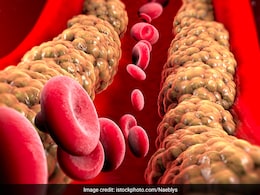 हाई कोलेस्ट्रॉल के मरीजों का कोलेस्ट्रॉल लेवल कितना होता है? जानिए नॉर्मल Cholesterol Level कितना होना चाहिए हाई कोलेस्ट्रॉल के मरीजों का कोलेस्ट्रॉल लेवल कितना होता है? जानिए नॉर्मल Cholesterol Level कितना होना चाहिए