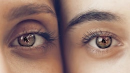 9 Diet Hacks That Say 'Goodbye' To Under-Eye Circles - No Expensive Creams Needed