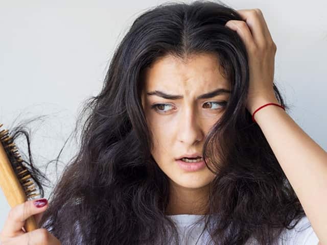 Haircare: Follow These Tips To Manage Hair Fall In Summer Haircare: Follow These Tips To Manage Hair Fall In Summer
