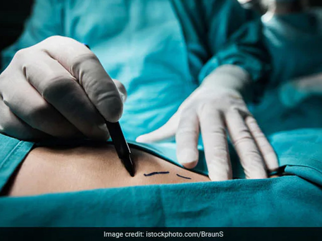 इंदौर में डॉक्टरों ने बुजुर्ग को दी नई जिंदगी, निकाले शरीर में धंसे तीन जहरीले तीर