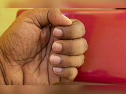 नाखूनों का पीलापन दूर करने के 6 घरेलू उपाय