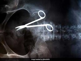 हायो रब्बा, ऑपरेशन के दौरान डॉक्टरों ने महिला के पेट में छोड़ी कैंची, 1 साल तक दर्द से तड़पती रही महिला हायो रब्बा, ऑपरेशन के दौरान डॉक्टरों ने महिला के पेट में छोड़ी कैंची, 1 साल तक दर्द से तड़पती रही महिला
