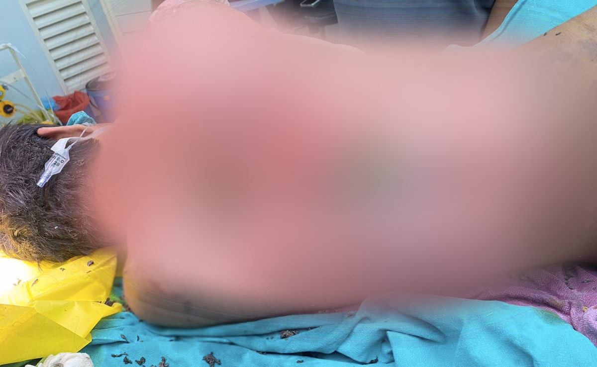 Class 11 Student Electrocuted At Hyderabad School, Suffers Over 50% Burns