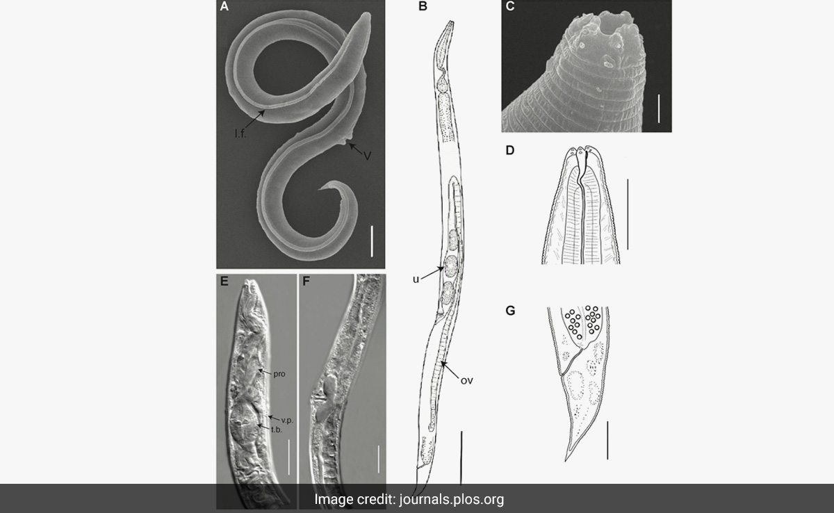 Scientists Revive 46,000-Year-Old Worm That Was Frozen In Siberian Permafrost