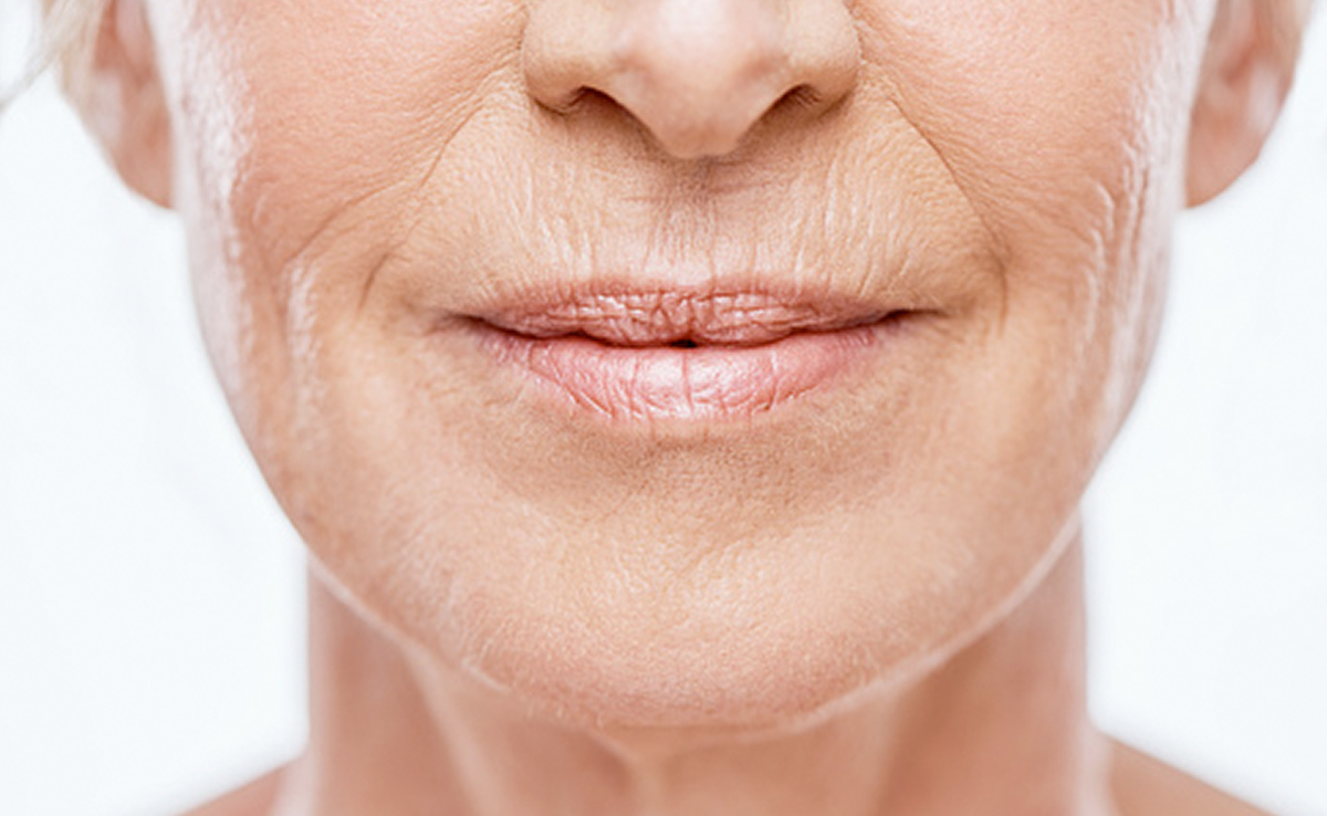 Wrinkles are considered a normal part of the ageing process