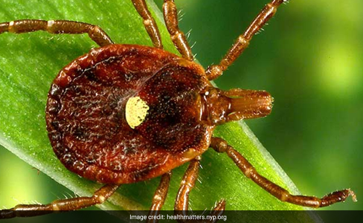 Alpha-Gal Syndrome: Meat Allergy Cases Linked To Tick Bites Grow In US, Warning Issued