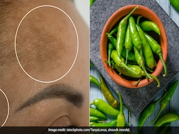 झुर्रियों और स्ट्रेच मार्क्स को दूर कर सकती है हरी मिर्च, गजब के फायदे, डाइटीशियन से जानें कब, कैसे और कितनी खानी चाहिए झुर्रियों और स्ट्रेच मार्क्स को दूर कर सकती है हरी मिर्च, गजब के फायदे, डाइटीशियन से जानें कब, कैसे और कितनी खानी चाहिए