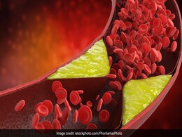 बढ़ने लगा है शरीर में कॉलेस्ट्रोल तो आज से ही इन 5 चीजों को खाना कर दें बंद, Cholesterol में इजाफा करते हैं ये फूड्स  बढ़ने लगा है शरीर में कॉलेस्ट्रोल तो आज से ही इन 5 चीजों को खाना कर दें बंद, Cholesterol में इजाफा करते हैं ये फूड्स