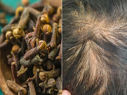 लौंग को बाल में इस तरह लगाने से हेयर लॉस से मिल सकता है छुटकारा, यहां जानिए हेयर केयर डीआईवाई लौंग को बाल में इस तरह लगाने से हेयर लॉस से मिल सकता है छुटकारा, यहां जानिए हेयर केयर डीआईवाई