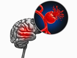 Head injury first aid: सिर पर चोट लगे तो फर्स्ट एड में तुरंत कर लें ये काम, जानिए कब लेनी चाहिए मेडिकल मदद Head injury first aid: सिर पर चोट लगे तो फर्स्ट एड में तुरंत कर लें ये काम, जानिए कब लेनी चाहिए मेडिकल मदद