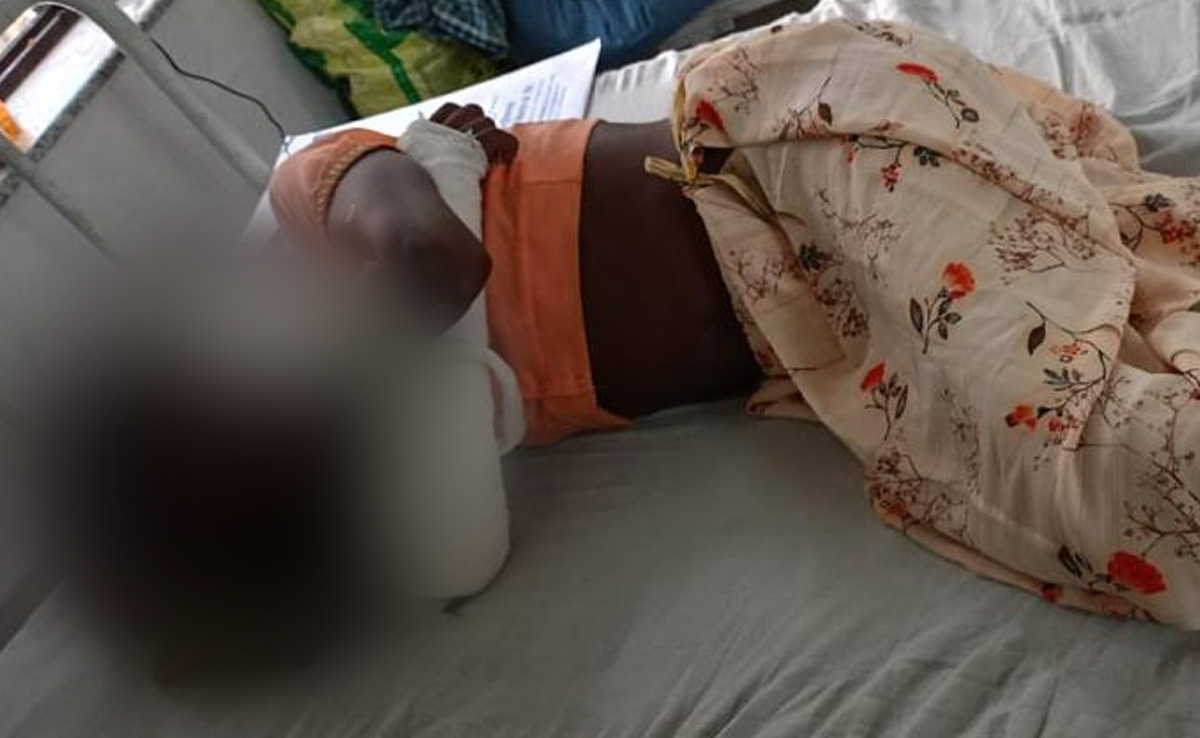 "अमानवीयता की हद...": बहू को डायन बताकर उसके दांत तोड़े, बाल काटे और गर्म सलाखों से दागा