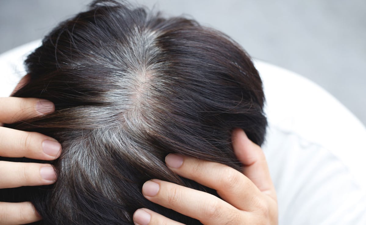 iaqld718_greying-of-hair_625x300_05_July_23 बालों को नेचुरली काला करने के लिए हफ्ते में दो बार बालो में लगा लीजिए ये चीज, कभी नहीं लगानी पड़ेगी मेहंदी और डाई