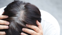Amla To Black Sesame, 5 Foods That May Help Slow Premature Greying Of Hair