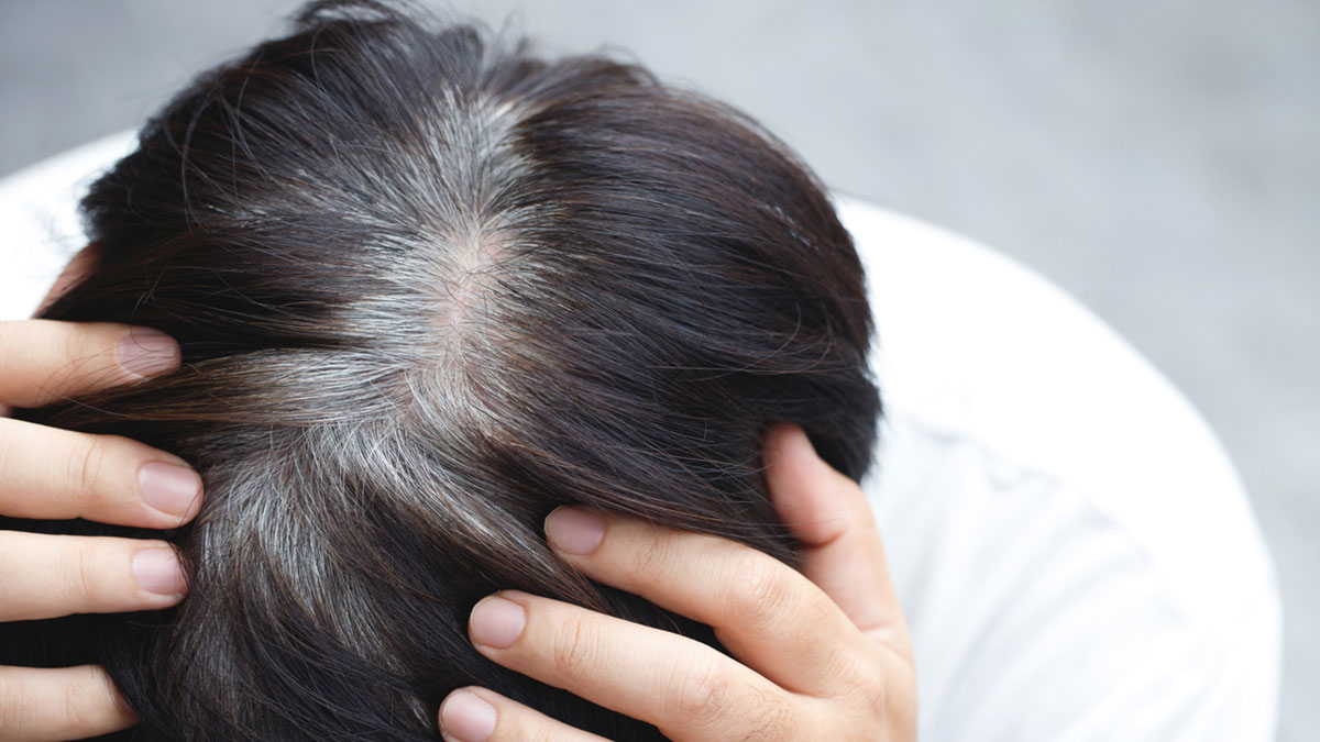 Amla To Black Sesame, 5 Foods That May Help Slow Premature Greying Of Hair