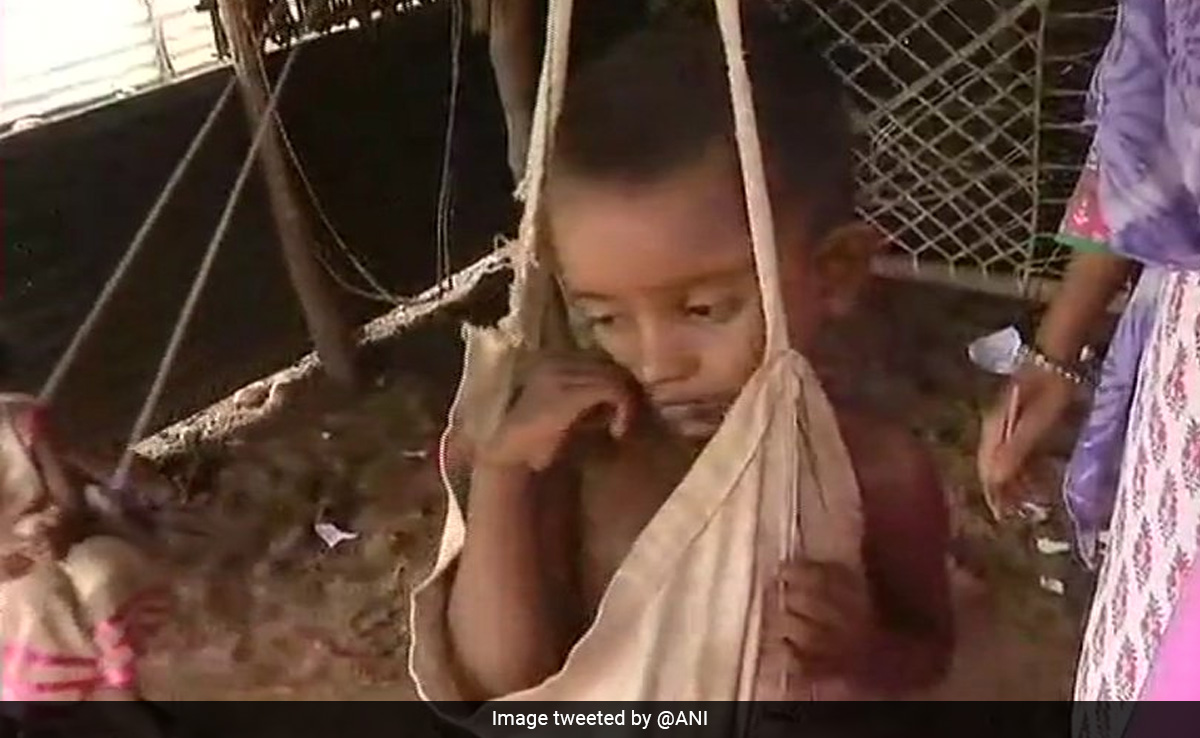 Nearly 78,000 Children Found Malnourished From January To March: Madhya Pradesh Data