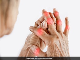 शरीर में यूरिक एसिड बढ़ने पर दिखने लगते हैं कुछ लक्षण, इन संकेतों को वक्त रहते पहचानने में है समझदारी  शरीर में यूरिक एसिड बढ़ने पर दिखने लगते हैं कुछ लक्षण, इन संकेतों को वक्त रहते पहचानने में है समझदारी
