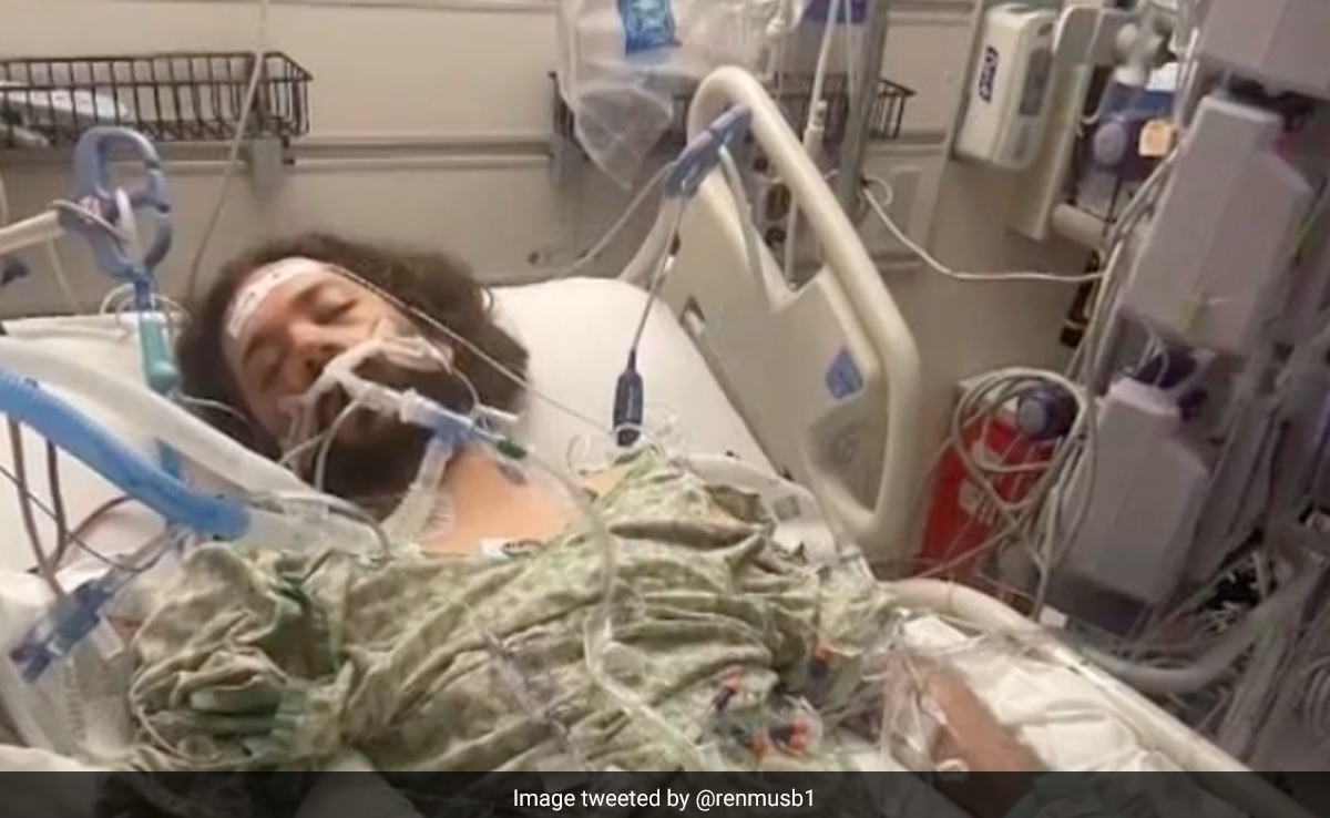 US Man Loses Hands And Feet From A Single Flea Bite. Here's How